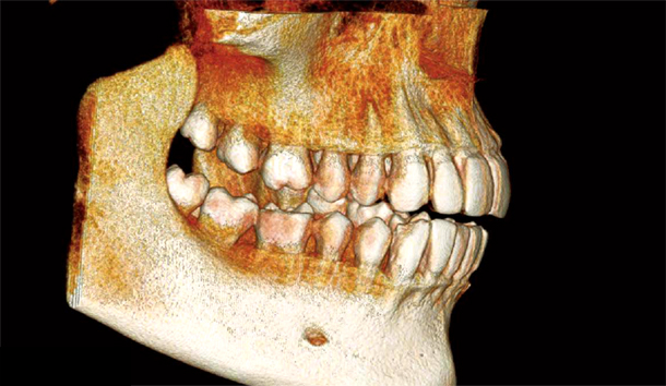 �ق������ȃt�@�C���L���[�ue2