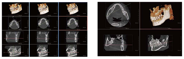 �ق������ȃt�@�C���L���[�ue2