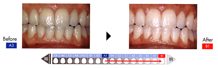 �z���C�g�j���O�C���[�W