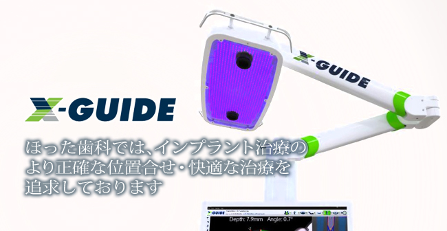 ��[��̂ق������Ȃł̓C���v�����g���Â̐��m�ŉ��K�Ȏ��g�݂����Ă���܂�